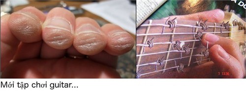 Cách giảm đau tay đơn giản mà hiệu quả cho người mới chơi đàn guitar